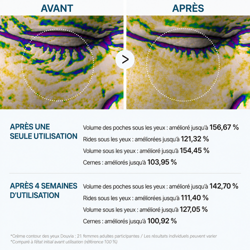 BEST-SELLER | Crème anti-poches EyeLift