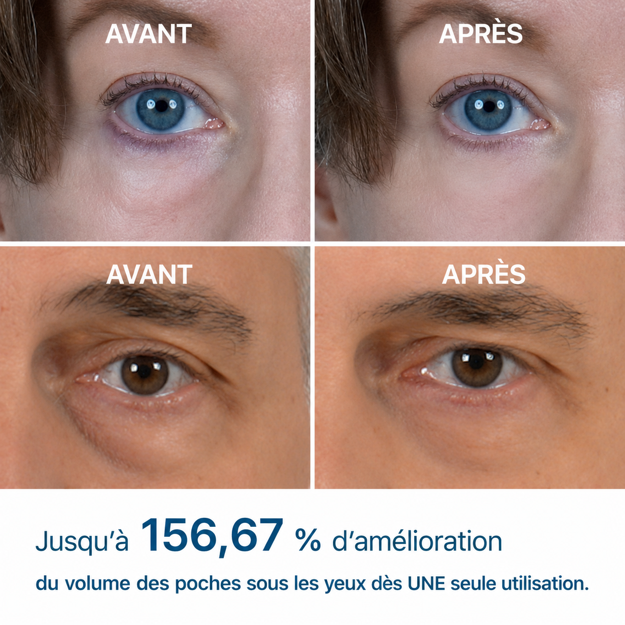 BEST-SELLER | Crème anti-poches EyeLift