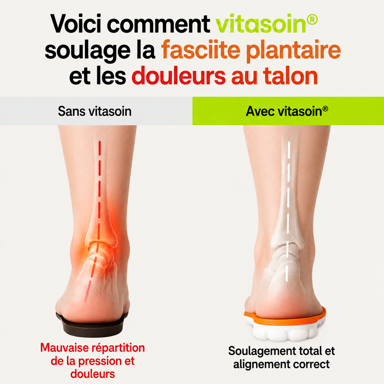 Semelles orthopédiques anti-douleur pour talons & fasciite plantaire